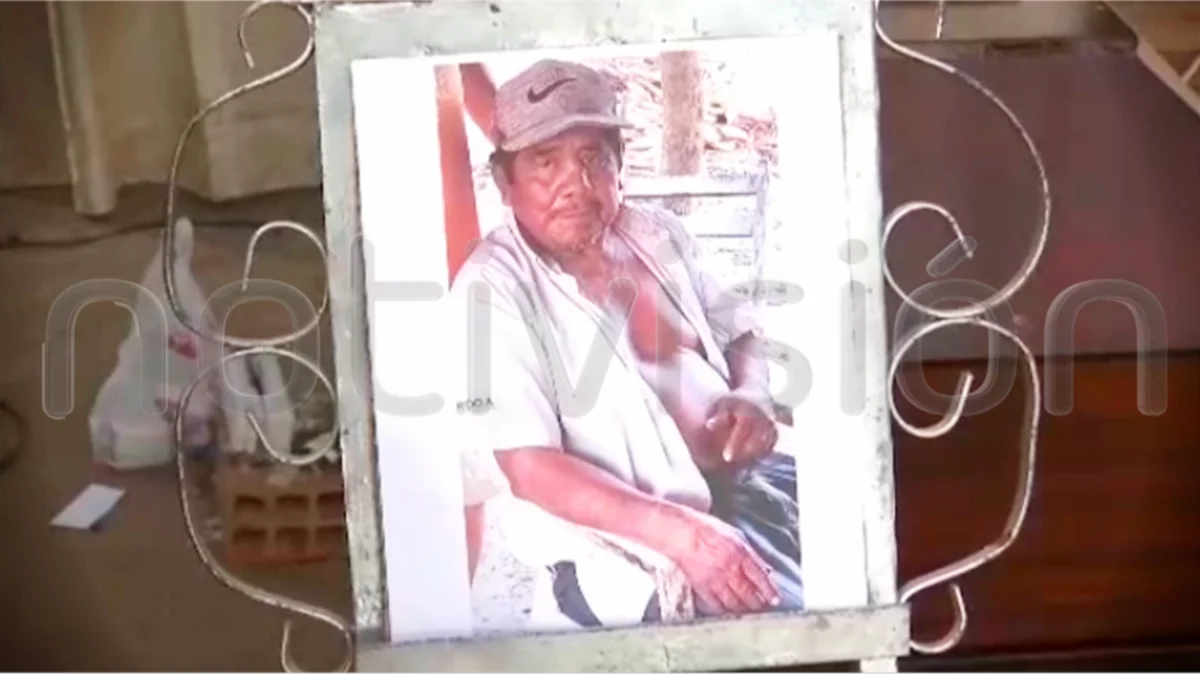 Tragedia en la comunidad Tajibo: Hombre de 66 años muere carbonizado en su vivienda mientras sufría de embolia y estaba en silla de ruedas.